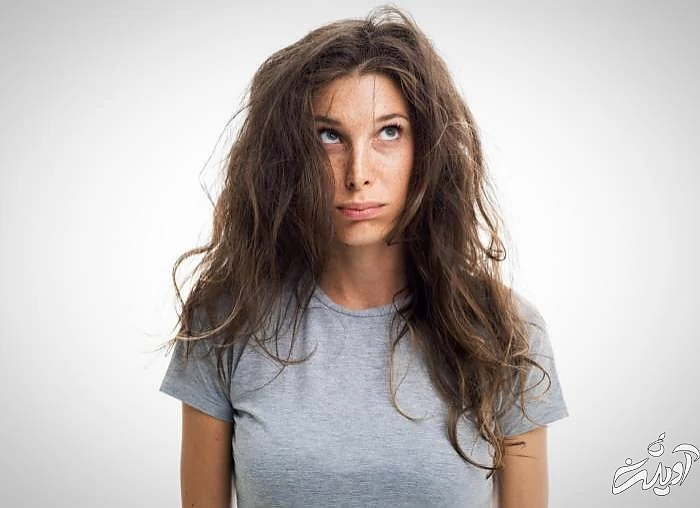 ژولیدگی مو به دلیل خوابیدن با موی باز ژولیدگی مو